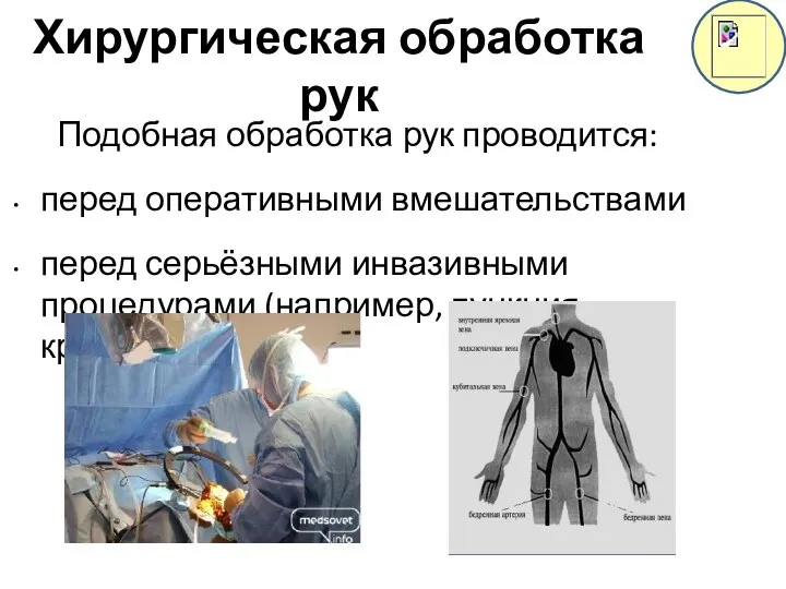 Хирургическая обработка рук Подобная обработка рук проводится: перед оперативными вмешательствами перед серьёзными инвазивными