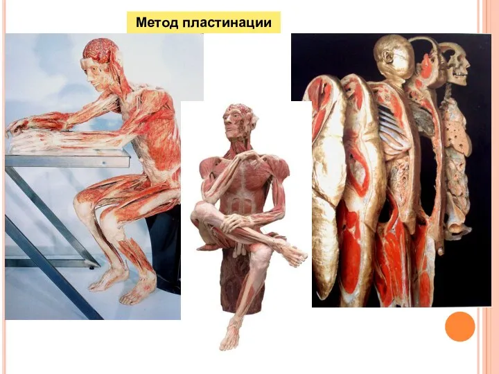 Метод пластинации