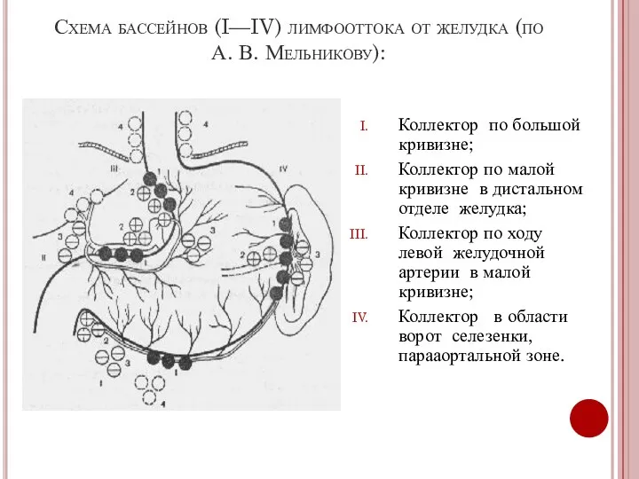 Схема бассейнов (I—IV) лимфооттока от желудка (по А. В. Мельникову):