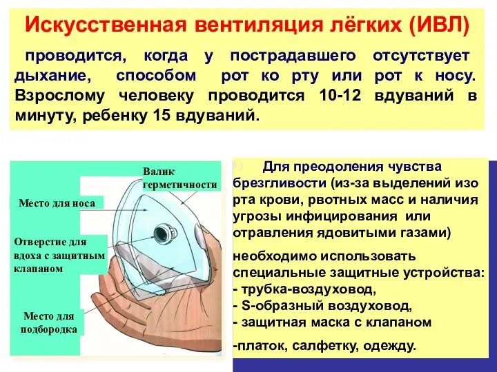 Искусственная вентиляция лёгких (ИВЛ) проводится, когда у пострадавшего отсутствует дыхание,