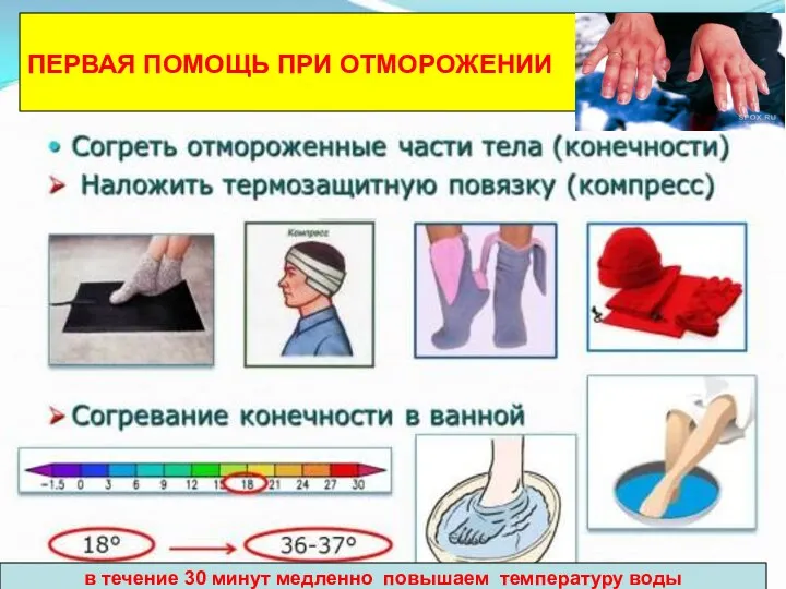 ПЕРВАЯ ПОМОЩЬ ПРИ ОТМОРОЖЕНИИ в течение 30 минут медленно повышаем температуру воды