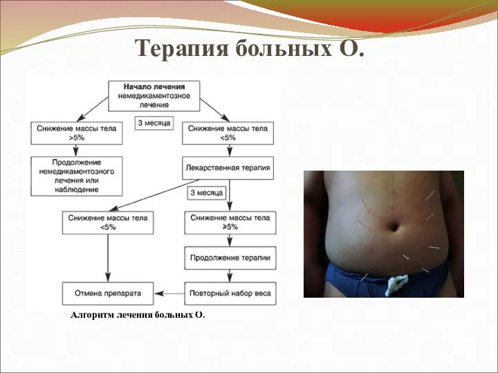 Терапия больных О. Алгоритм лечения больных О.