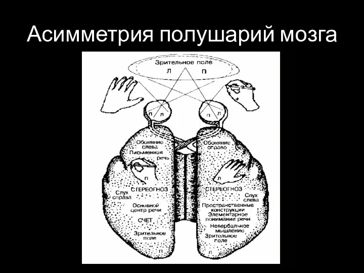 Асимметрия полушарий мозга