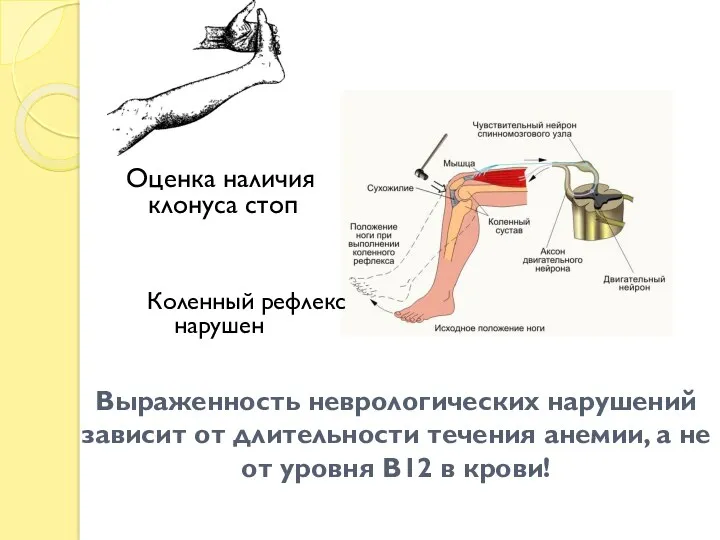 Выраженность неврологических нарушений зависит от длительности течения анемии, а не