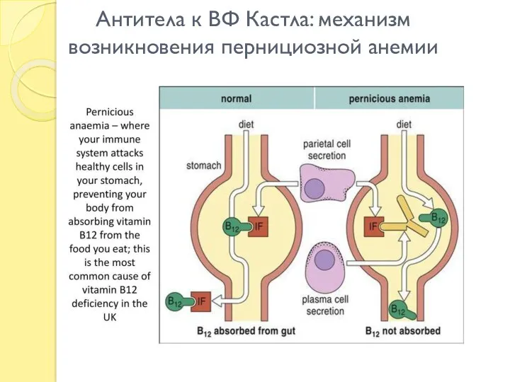 Антитела к ВФ Кастла: механизм возникновения пернициозной анемии