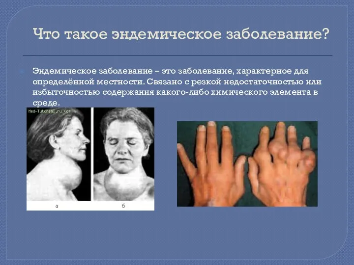 Что такое эндемическое заболевание? Эндемическое заболевание – это заболевание, характерное