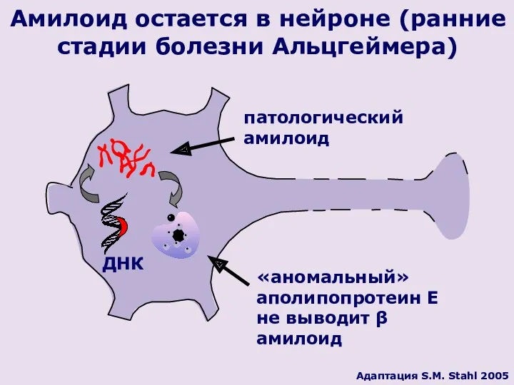 патологический амилоид «аномальный» аполипопротеин Е не выводит β амилоид ДНК Амилоид остается в