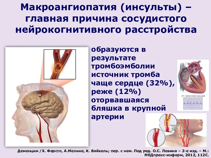 Макроангиопатия (инсульты) – главная причина сосудистого нейрокогнитивного расстройства образуются в