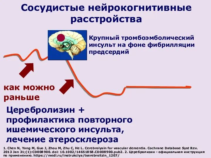 Крупный тромбоэмболический инсульт на фоне фибрилляции предсердий Сосудистые нейрокогнитивные расстройства Церебролизин + профилактика