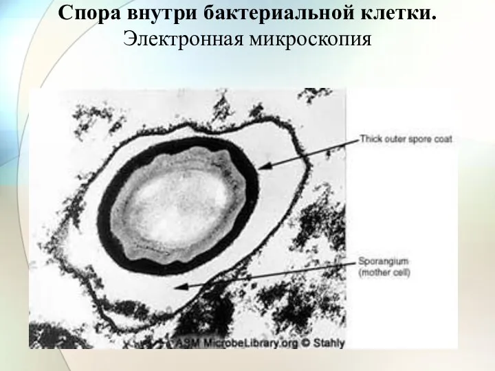 Спора внутри бактериальной клетки. Электронная микроскопия