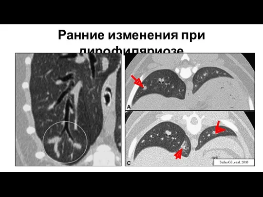 Ранние изменения при дирофиляриозе Seiler GS, et al. 2010