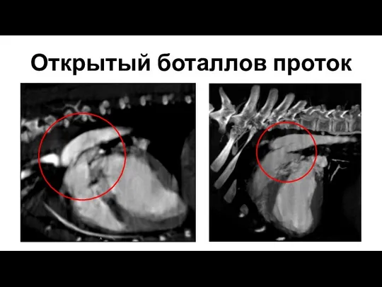 Открытый боталлов проток