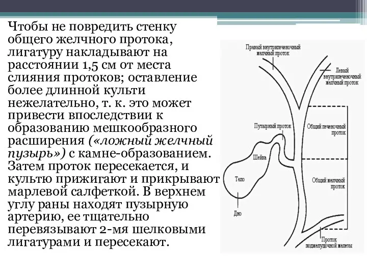 Чтобы не повредить стенку общего желчного протока, лигатуру накладывают на