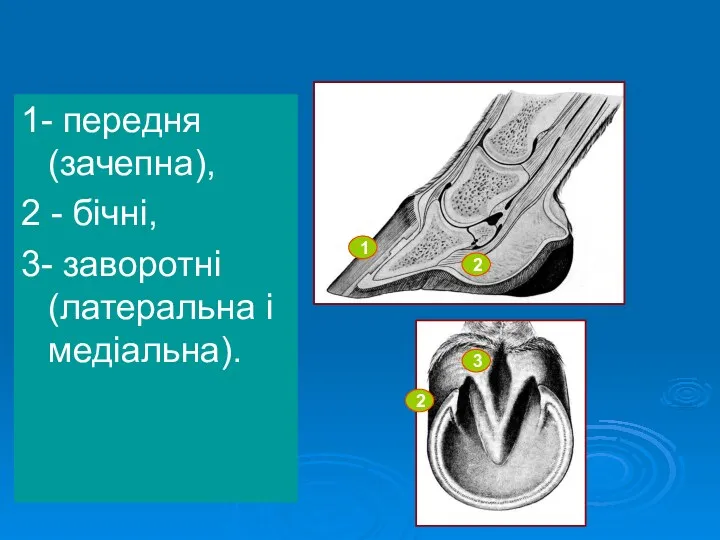 Частини копитної стінки: 1- передня (зачепна), 2 - бічні, 3-