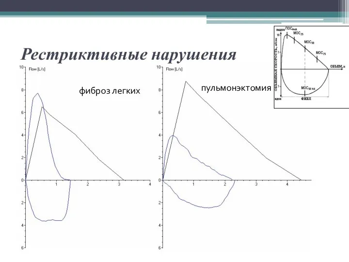 Рестриктивные нарушения фиброз легких пульмонэктомия