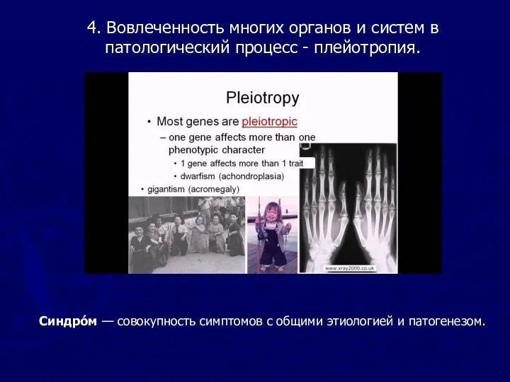 4. Вовлеченность многих органов и систем в патологический процесс -