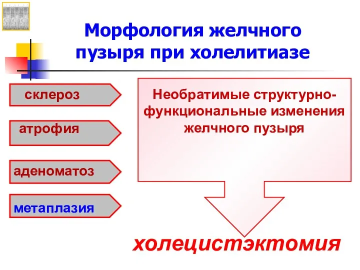 холецистэктомия аденоматоз атрофия склероз метаплазия Необратимые структурно-функциональные изменения желчного пузыря Морфология желчного пузыря при холелитиазе