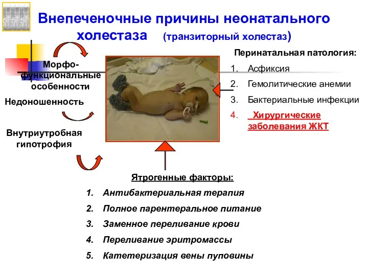 Внепеченочные причины неонатального холестаза (транзиторный холестаз) Морфо-функциональные особенности Перинатальная патология: