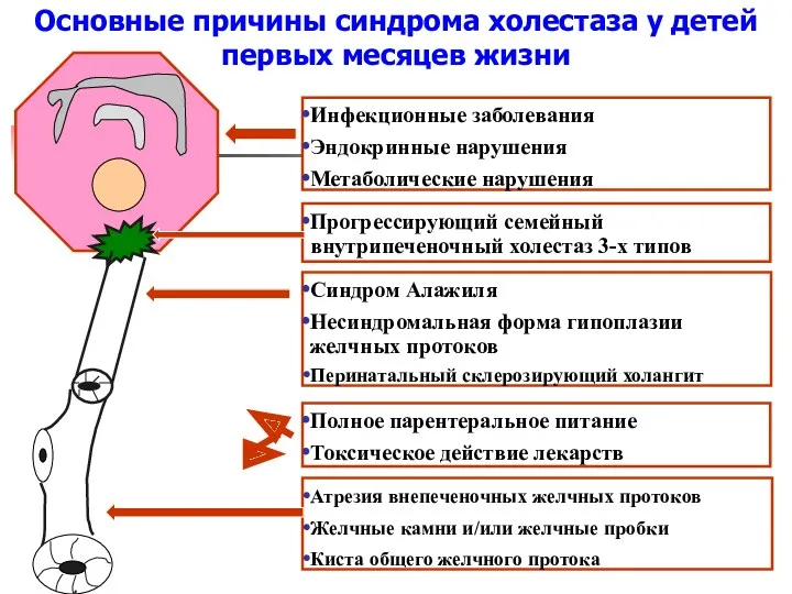 Инфекционные заболевания Эндокринные нарушения Метаболические нарушения Прогрессирующий семейный внутрипеченочный холестаз