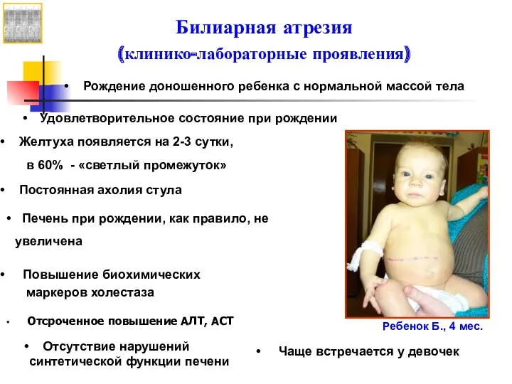 Удовлетворительное состояние при рождении Печень при рождении, как правило, не