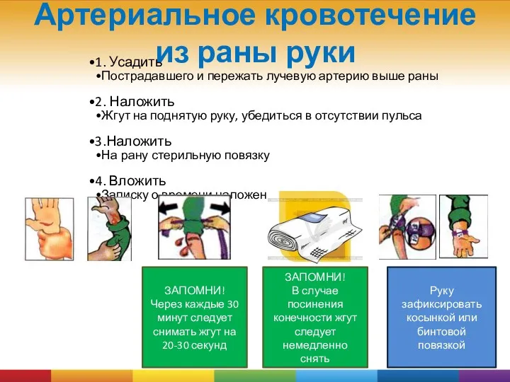 Артериальное кровотечение из раны руки 1. Усадить Пострадавшего и пережать