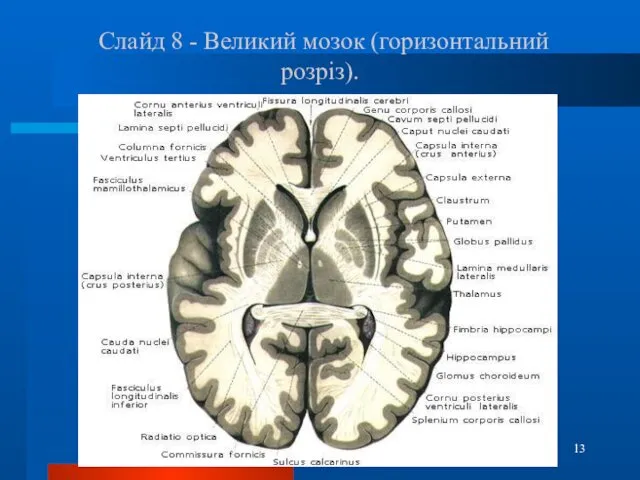 Слайд 8 - Великий мозок (горизонтальний розріз).