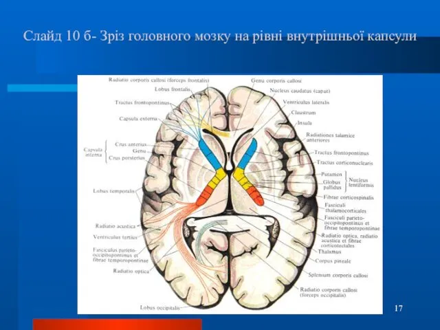 Слайд 10 б- Зріз головного мозку на рівні внутрішньої капсули