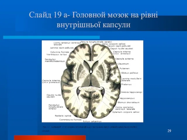 Слайд 19 а- Головной мозок на рівні внутрішньої капсули