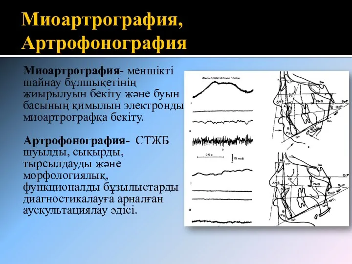 Миоартрография, Артрофонография Миоартрография- меншікті шайнау бұлшықетінің жиырылуын бекіту және буын