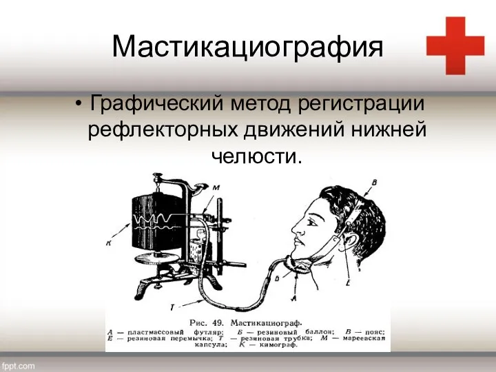 Мастикациография Графический метод регистрации рефлекторных движений нижней челюсти.