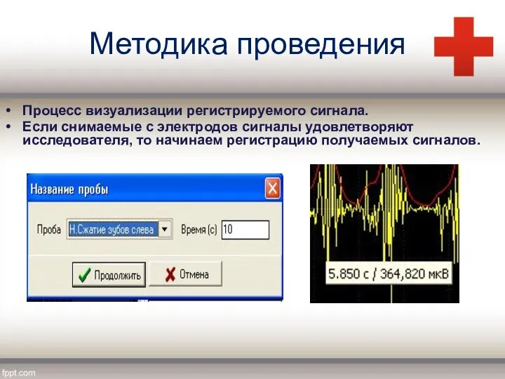 Методика проведения Процесс визуализации регистрируемого сигнала. Если снимаемые с электродов сигналы удовлетворяют исследователя,