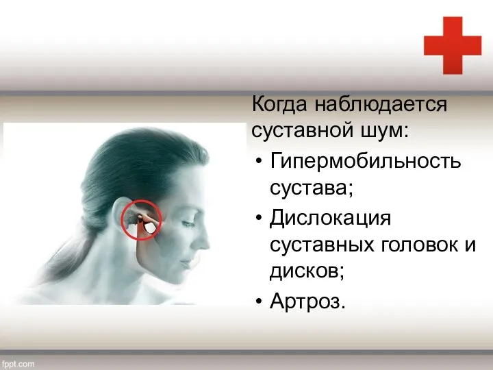 Когда наблюдается суставной шум: Гипермобильность сустава; Дислокация суставных головок и дисков; Артроз.