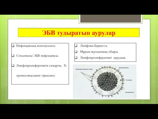 ЭБВ тудыратын аурулар Инфекциялық мононуклеоз. Созылмалы ЭБВ инфекциясы. Лимфопролифертивтік синдром,