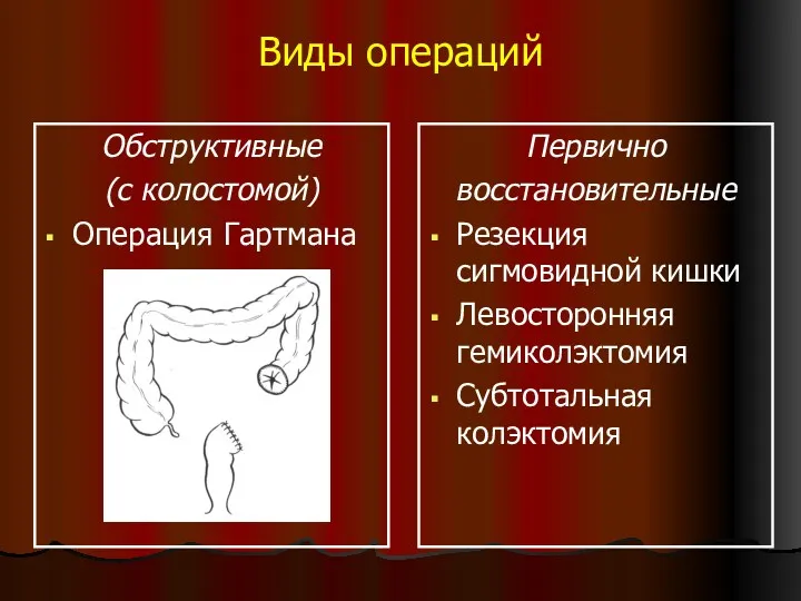 Виды операций Обструктивные (с колостомой) Операция Гартмана Первично восстановительные Резекция сигмовидной кишки Левосторонняя гемиколэктомия Субтотальная колэктомия