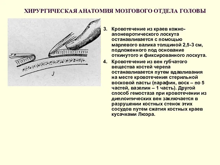 ХИРУРГИЧЕСКАЯ АНАТОМИЯ МОЗГОВОГО ОТДЕЛА ГОЛОВЫ 3. Кровотечение из краев кожно-апоневротического