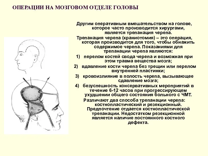 ОПЕРАЦИИ НА МОЗГОВОМ ОТДЕЛЕ ГОЛОВЫ Другим оперативным вмешательством на голове,