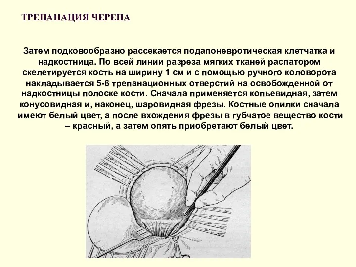 ТРЕПАНАЦИЯ ЧЕРЕПА Затем подковообразно рассекается подапоневротическая клетчатка и надкостница. По