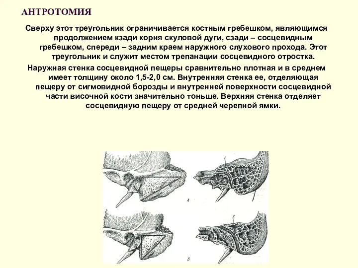 АНТРОТОМИЯ Сверху этот треугольник ограничивается костным гребешком, являющимся продолжением кзади