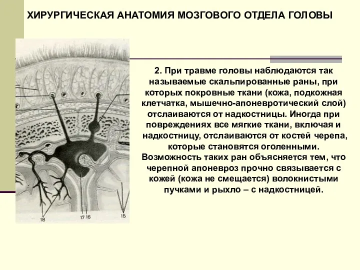 2. При травме головы наблюдаются так называемые скальпированные раны, при