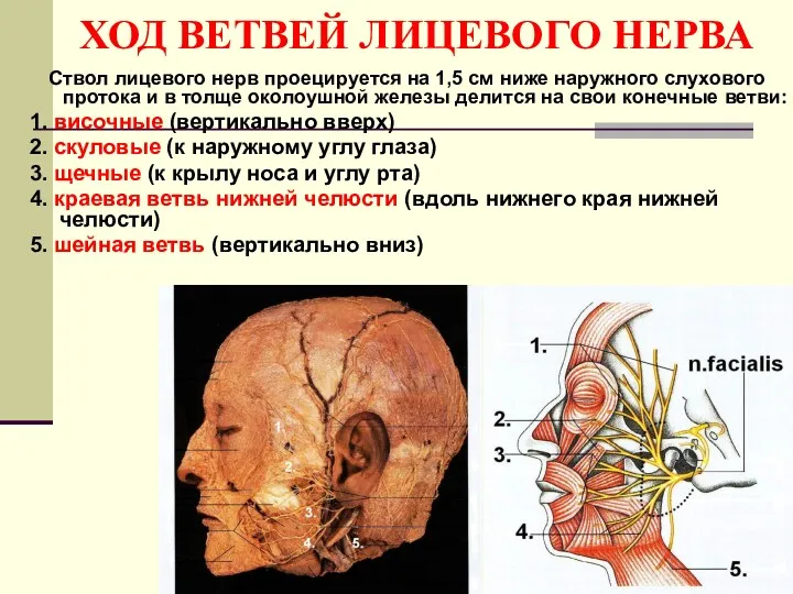 ХОД ВЕТВЕЙ ЛИЦЕВОГО НЕРВА Ствол лицевого нерв проецируется на 1,5