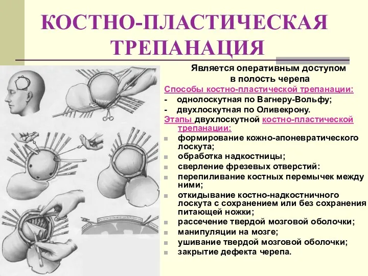 КОСТНО-ПЛАСТИЧЕСКАЯ ТРЕПАНАЦИЯ Является оперативным доступом в полость черепа Способы костно-пластической