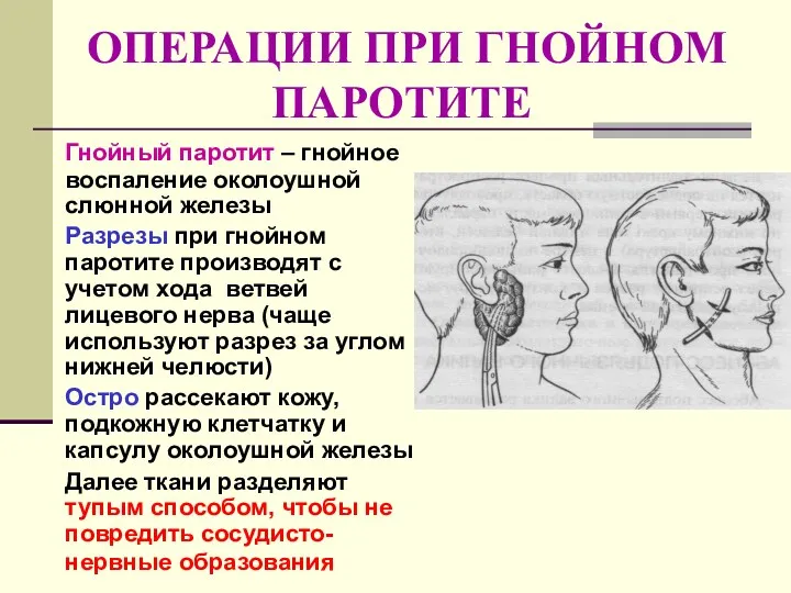 ОПЕРАЦИИ ПРИ ГНОЙНОМ ПАРОТИТЕ Гнойный паротит – гнойное воспаление околоушной