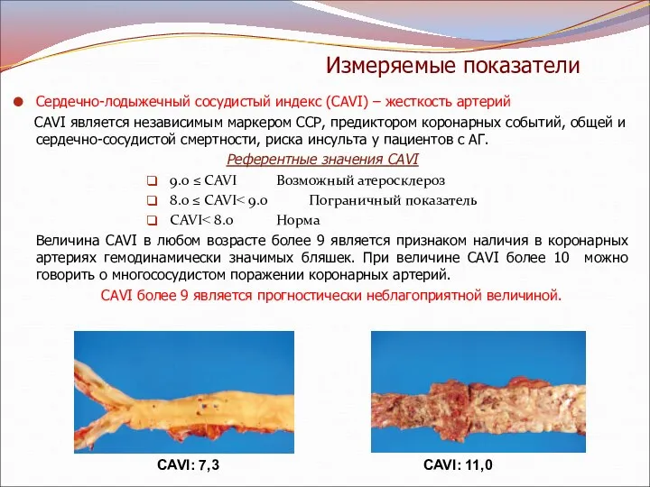 Измеряемые показатели Сердечно-лодыжечный сосудистый индекс (CAVI) – жесткость артерий CAVI