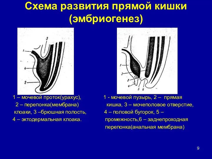 Схема развития прямой кишки(эмбриогенез) 1 – мочевой проток(урахус), 1 -