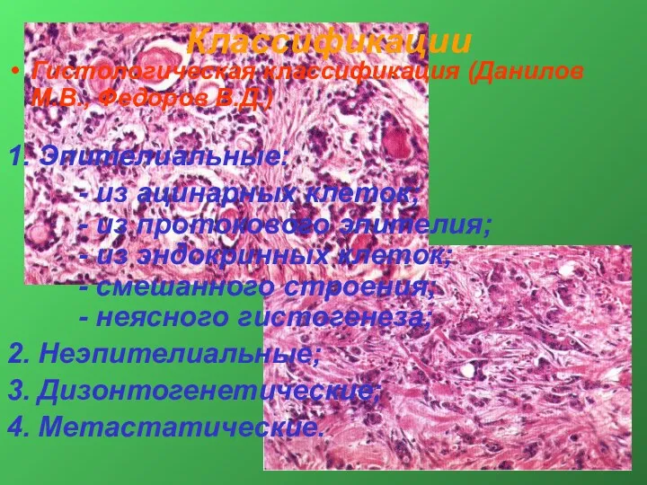 Классификации Гистологическая классификация (Данилов М.В., Федоров В.Д.) 1. Эпителиальные: -