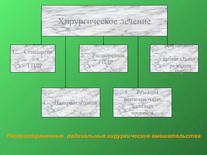 Хирургическое лечение Стандартная ГПДР Расширенная ГПДР Дистальная субтотальная резекция ПЖ