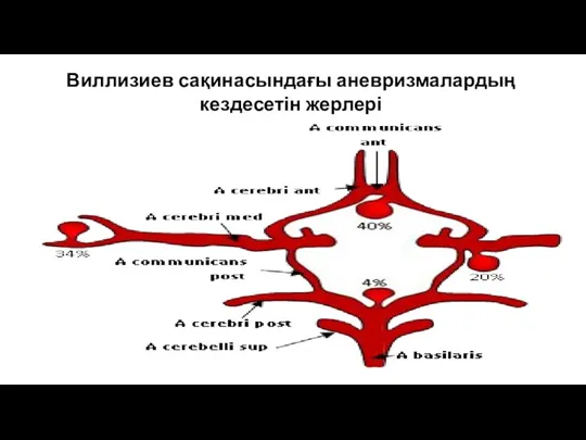 Виллизиев сақинасындағы аневризмалардың кездесетін жерлері