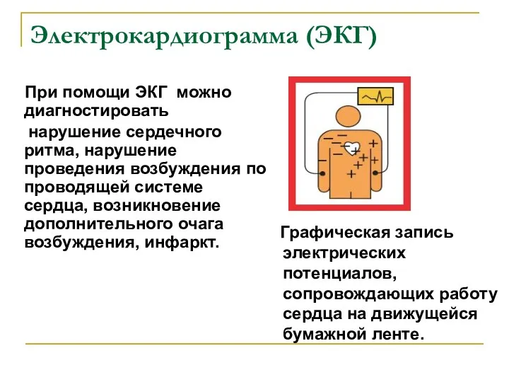 Электрокардиограмма (ЭКГ) При помощи ЭКГ можно диагностировать нарушение сердечного ритма,