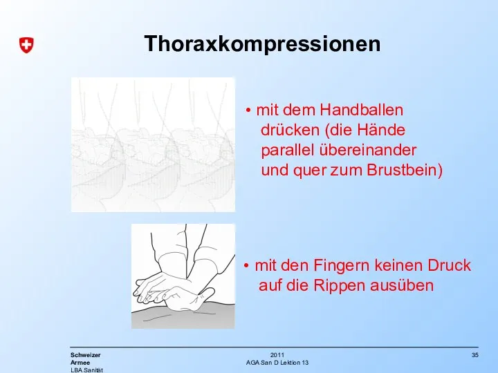 AGA San D Lektion 13 Thoraxkompressionen mit dem Handballen drücken