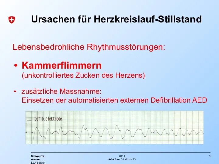 AGA San D Lektion 13 Ursachen für Herzkreislauf-Stillstand Lebensbedrohliche Rhythmusstörungen: